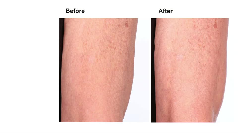 The skin on this leg has changed, with some darker marks appearing less prominent. This is the result of a beauty product, likely seen on QVC UK.