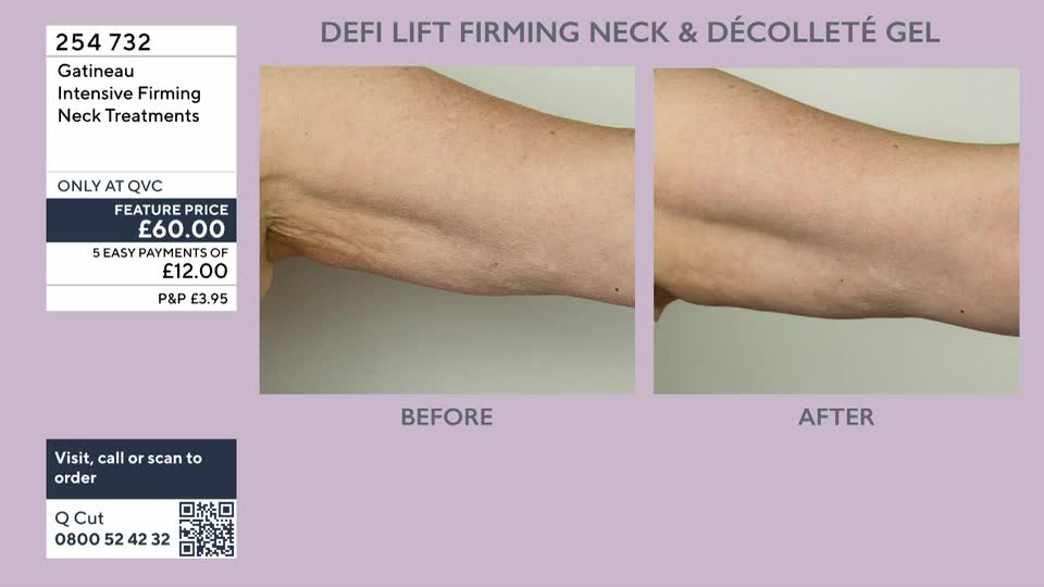 The skin on this arm shows noticeable wrinkles before, and appears smoother after. Gatineau's Defi Lift Firming Neck & Décolleté Gel is available on QVC.