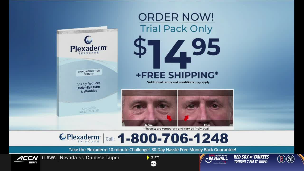 The ACC Network is showing a commercial for Plexaderm, featuring a before-and-after comparison of a man's eyes. The advertisement highlights a trial pack for $14.95 with free shipping.
