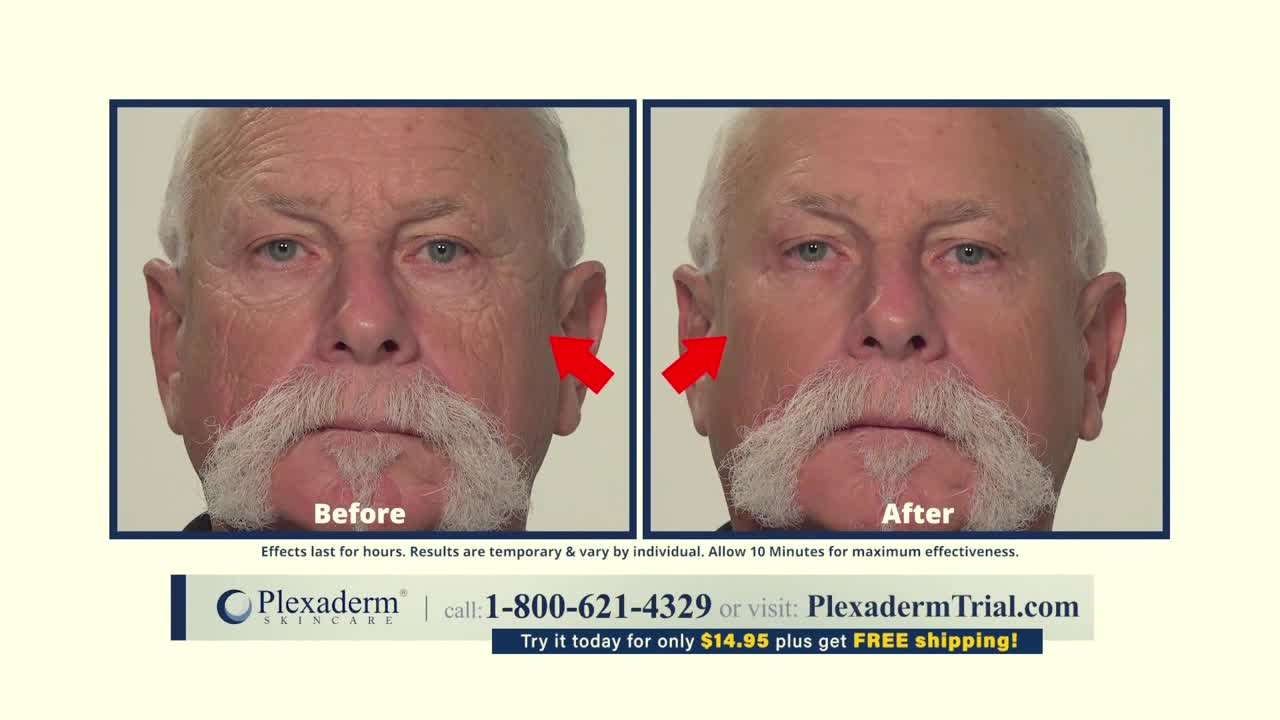 A split screen shows a man's face, first with wrinkles, then smoother. Red arrows point from the "Before" image towards the "After," as if indicating a transformation.
