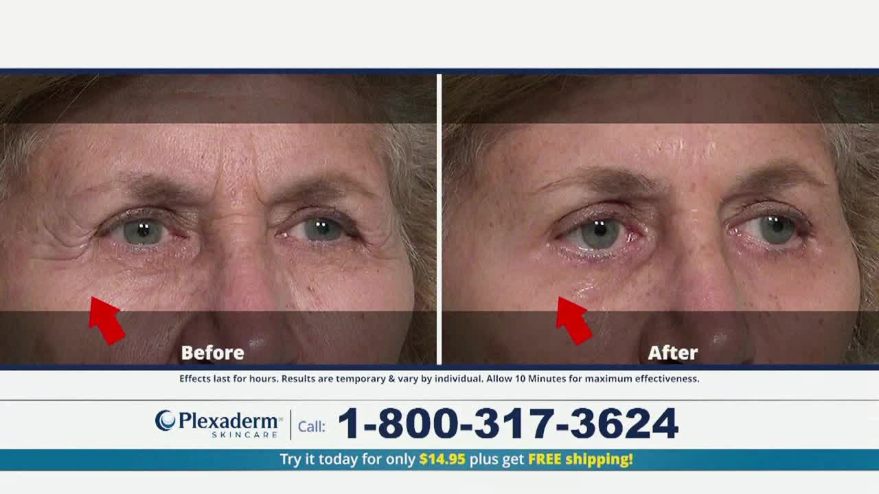 On the Fox Business Network, a side-by-side comparison shows a woman's eyes, with wrinkles noticeably reduced in the "after" photo. A red arrow points to the area under the eye in both images, highlighting the change.
