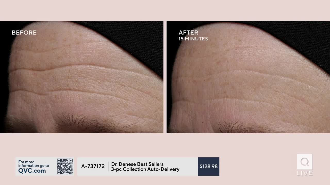 The forehead on the left shows deep wrinkles, while the one on the right, after 15 minutes, appears smoother. This QVC presentation highlights the product's immediate effects.