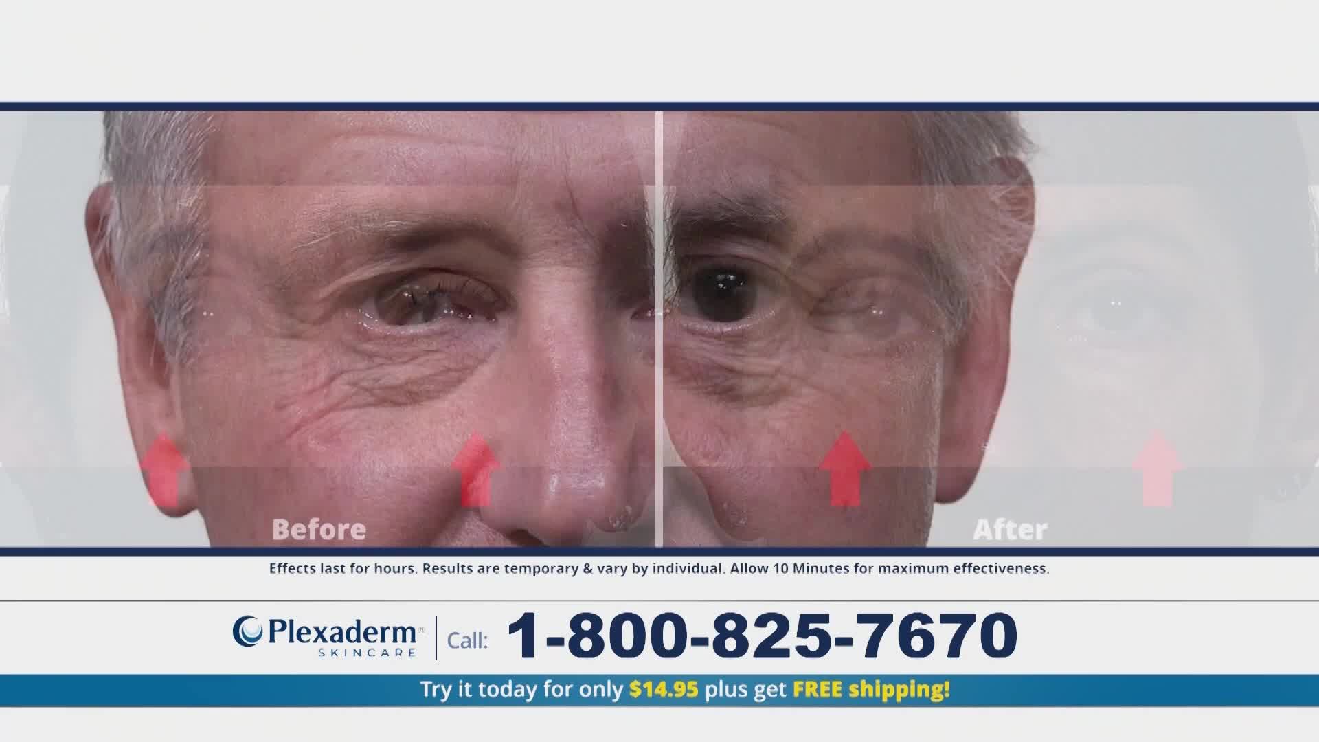 A man's face is split down the middle, showing a "before" and "after" comparison. Red arrows point to areas where his skin appears smoother in the "after" section. The Plexaderm logo and a phone number are displayed below the image.