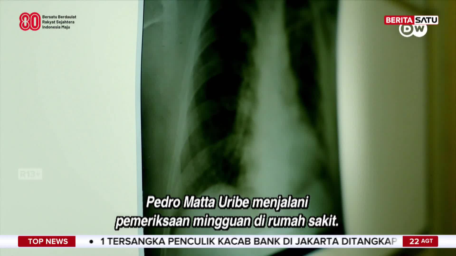 An X-ray of a chest is displayed on the screen, with the ribs clearly visible. The BeritaSatu English news segment from Indonesia is reporting on Pedro Matta Uribe's weekly check-up at the hospital.
