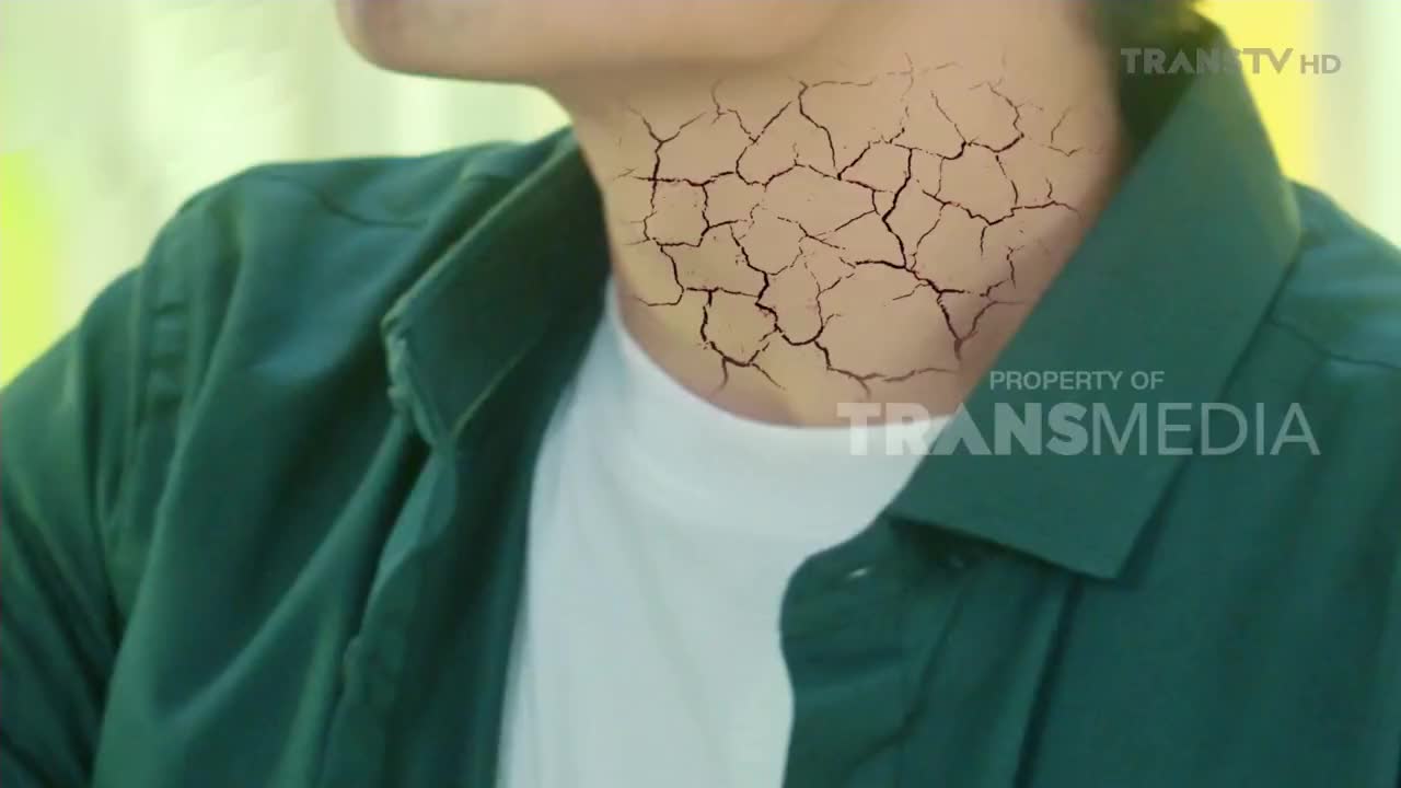A man's neck is covered in a network of cracks, as if the skin is drying out. The Trans TV logo is visible, suggesting this scene is part of a broadcast from Indonesia.
