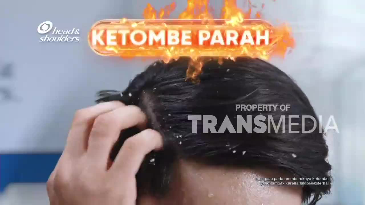 A hand scratches at dark hair, dislodging flakes. Above, a fiery graphic declares "KETOMBE PARAH," a common concern in Indonesia. A hand scratches at dark hair, dislodging flakes. Above, a fiery graphic declares "KETOMBE PARAH," a common concern in Indonesia.