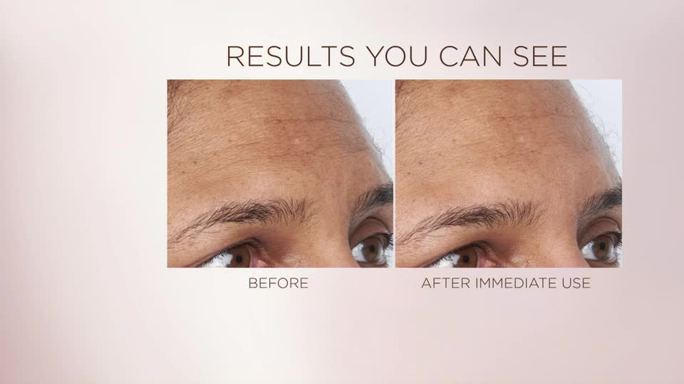 Two close-up images of a forehead show a clear difference. The left side, labeled "BEFORE," displays noticeable lines, while the right side, "AFTER IMMEDIATE USE," shows those same lines significantly softened.