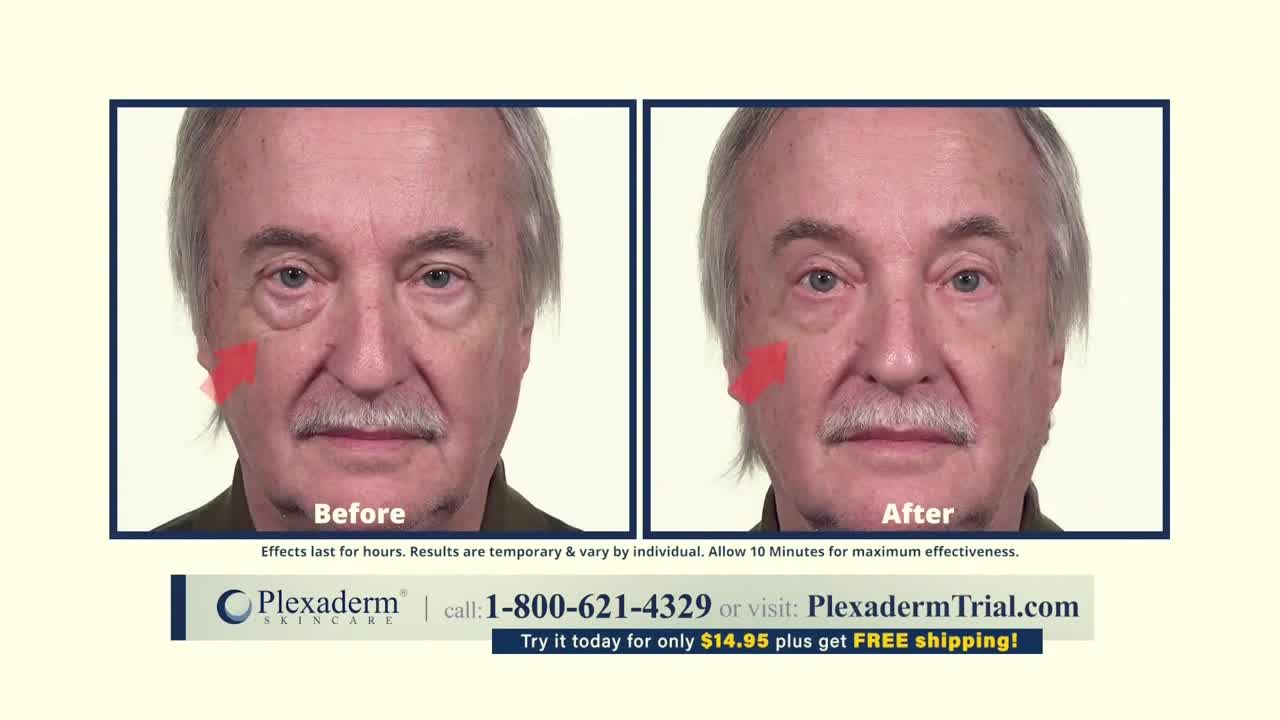 A split screen shows a man's face, with one side labeled "Before" and the other "After." A red arrow points to the area under his eye in both images, supposedly highlighting the product's effect.
