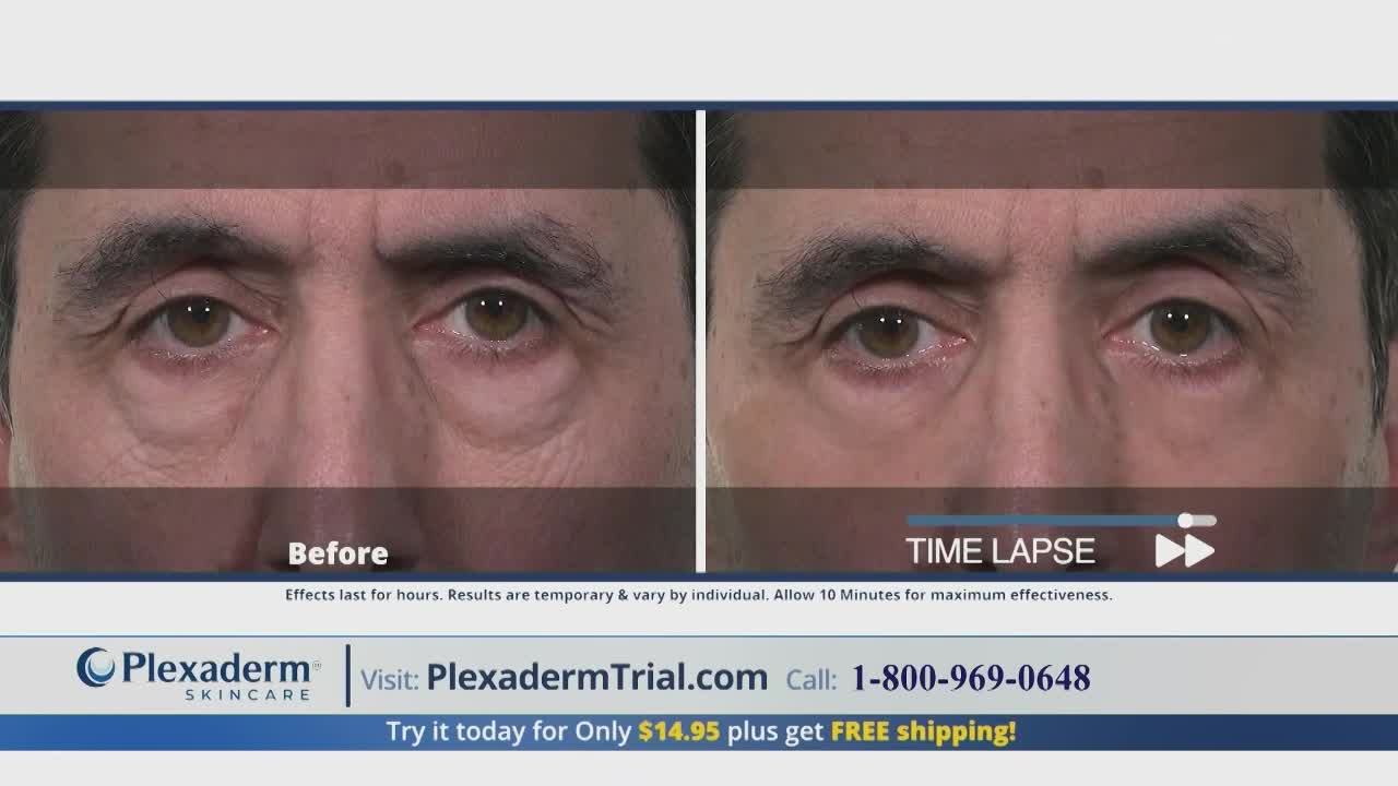 The man's puffy under-eye bags are noticeably reduced in the "Time Lapse" image. The advertisement for Plexaderm skincare promises a quick fix for wrinkles.
