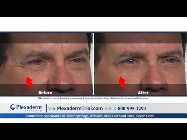 A split screen shows a man's face, with one side labeled "Before" and the other "After," highlighting the area around his eye. The "After" side appears smoother, and a red arrow points to the change.
