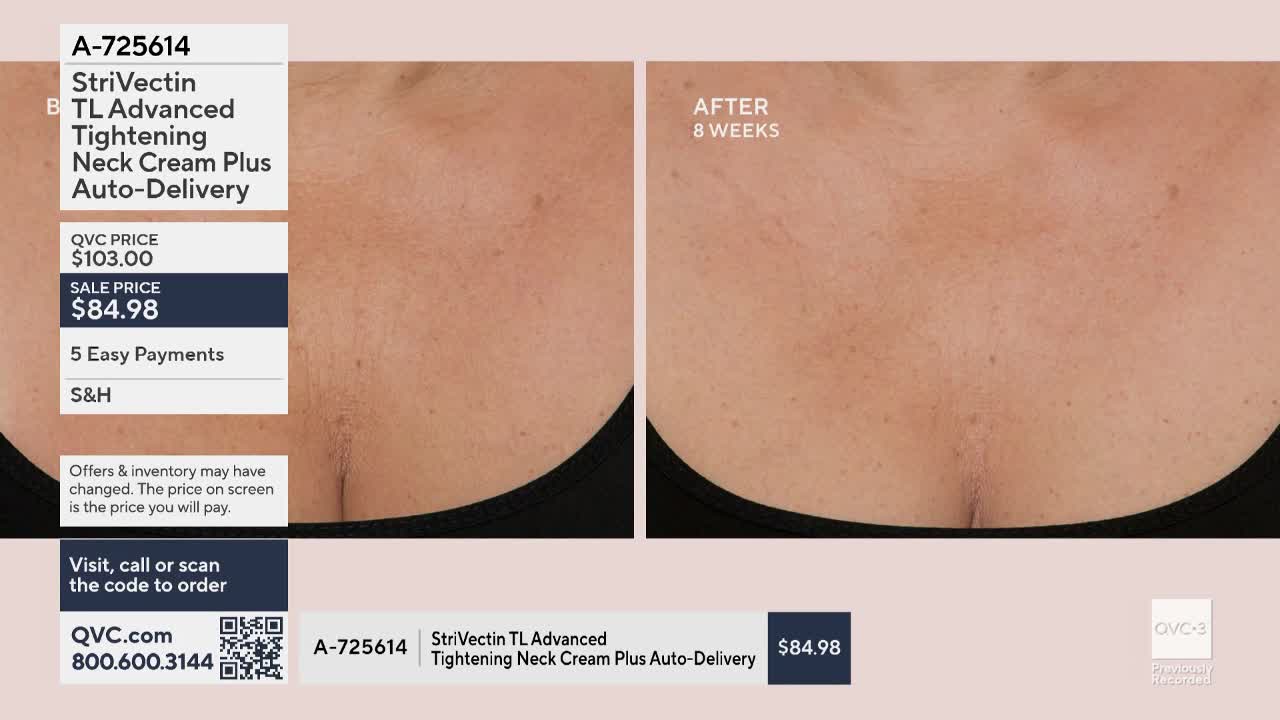 On QVC3, a split screen shows a before-and-after comparison of a woman's décolletage. The "after" image, labeled "8 weeks," appears smoother than the "before" image.
