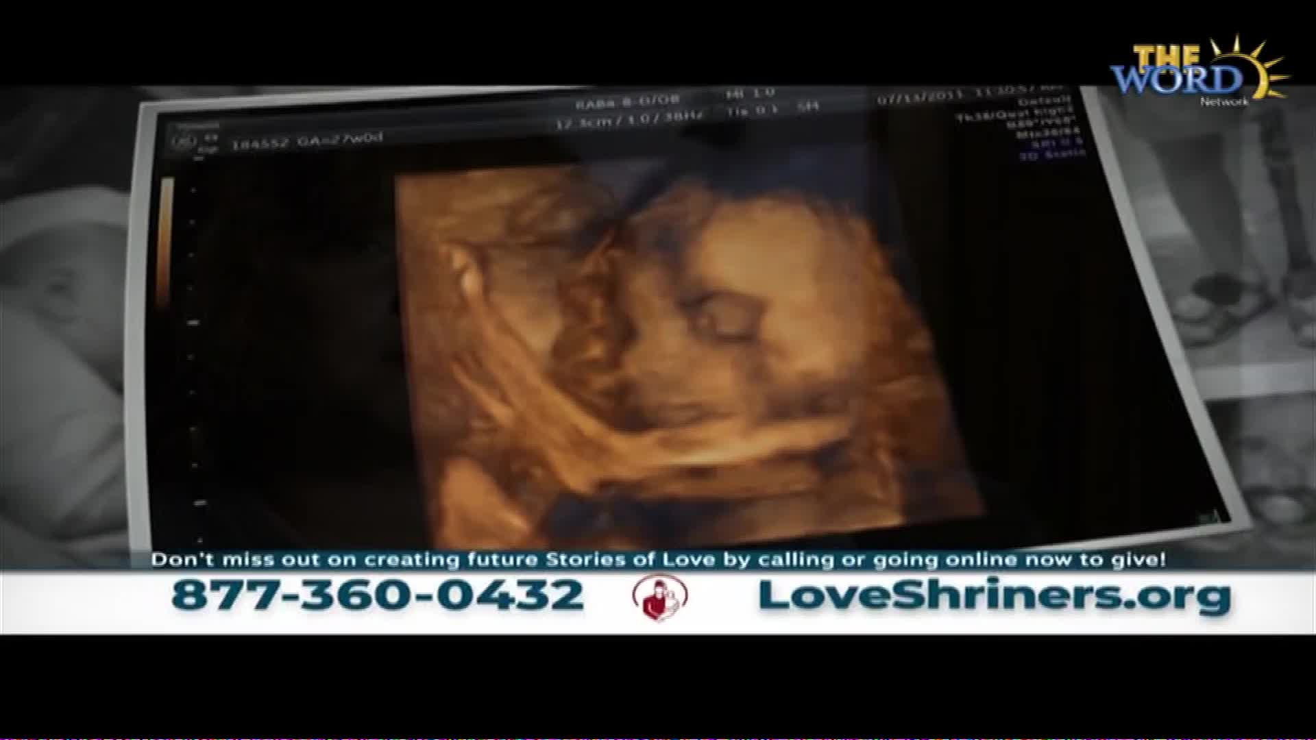 A 3D ultrasound displays a baby's face, its features rendered in warm, earthy tones. Below, a phone number and website encourage donations to LoveShriners.org.