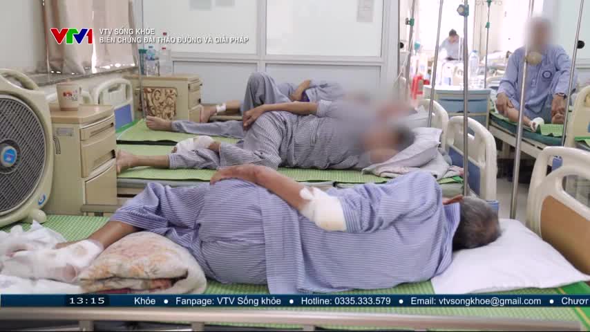 Patients in striped pajamas lie in hospital beds, some with bandaged limbs, under the watchful eye of VTV1. A fan hums in the corner, and the scene is punctuated by the quiet sounds of medical care.

